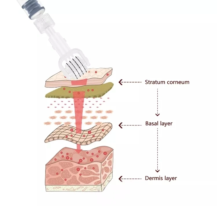 72 Titanium Micro Needles Collage Introduction Serum Delivery Dermaroller